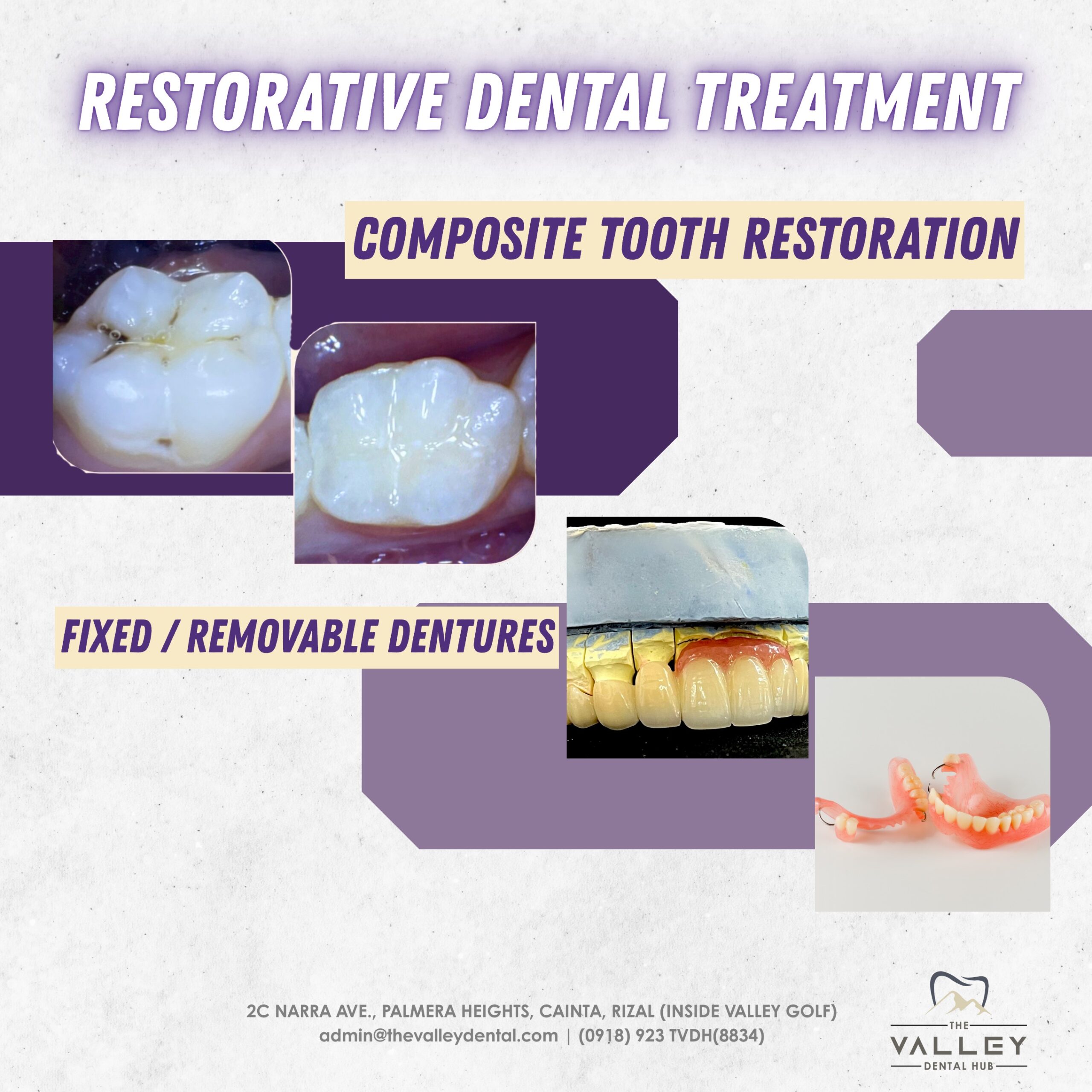 Restorative Dental Treatment Services: Composite Tooth Restoration Fixed/Removable Dentures